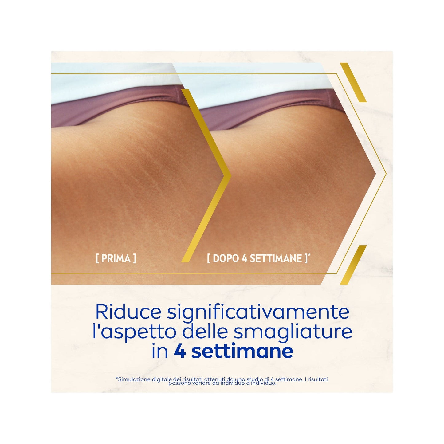 Nivea Luminous630 Olio-siero Corpo Antismagliature Per La Cura Corpo 100ml