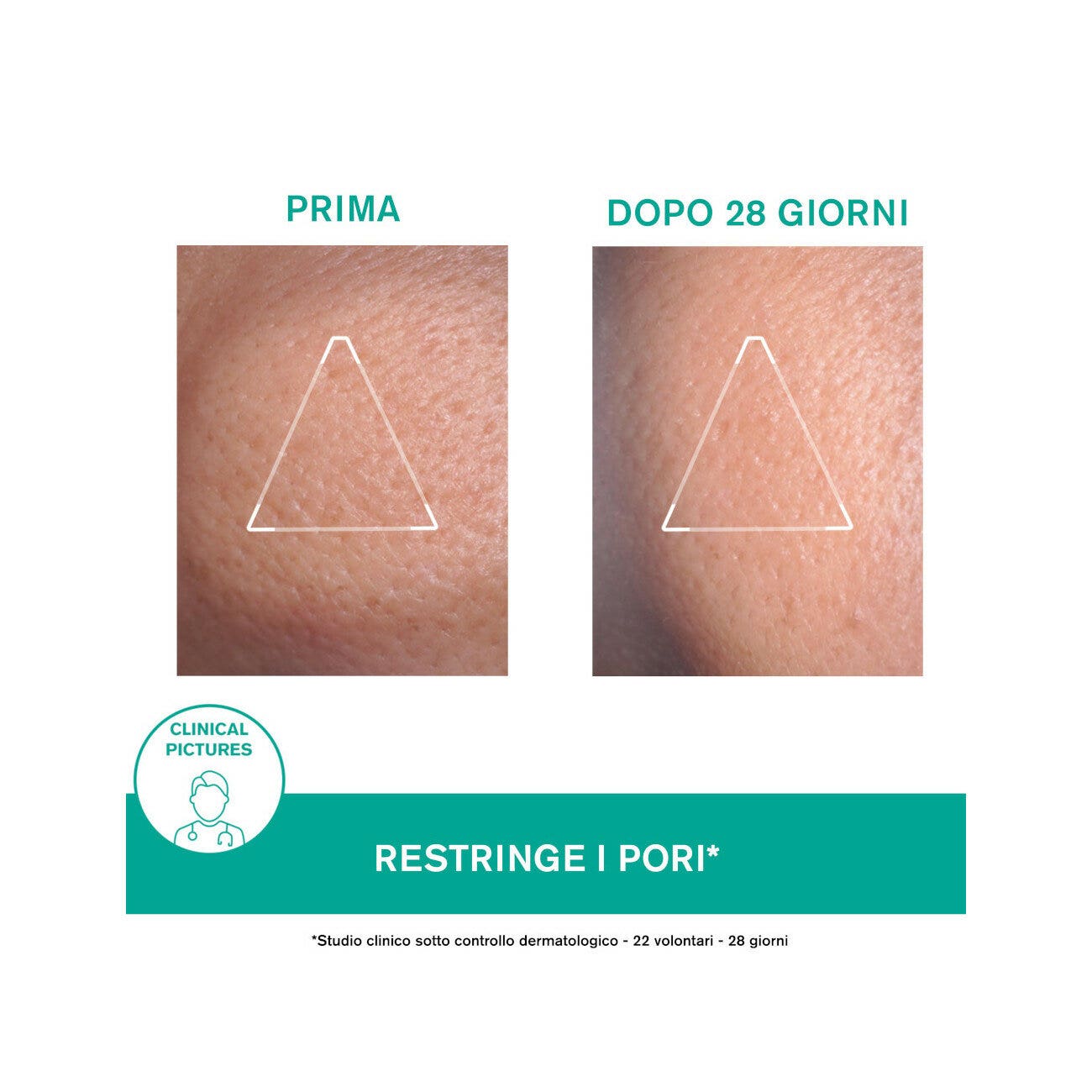 Uriage Hyséac Mat Crema 40ml