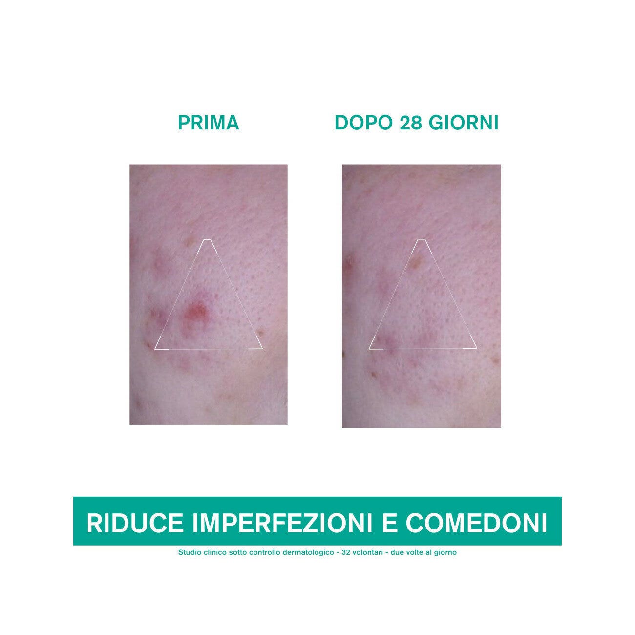 Uriage Hyseac 3 Regul+ Trattamento Globale Anti-imperfezioni 40ml