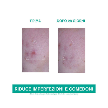 Uriage Hyseac 3 Regul+ Trattamento Globale Anti-imperfezioni 40ml